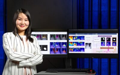 New AI Tool Imitates Radiologist’s Gaze to Analyze X-Rays